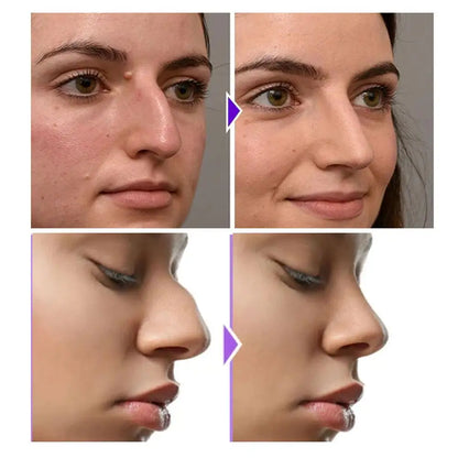 Nose Sculpting Device Nose Shaper Clip Soft Silicone Nose Up Lifting  Device Nose Slimmer For Wide Big Nose NO Pain Beauty Tool